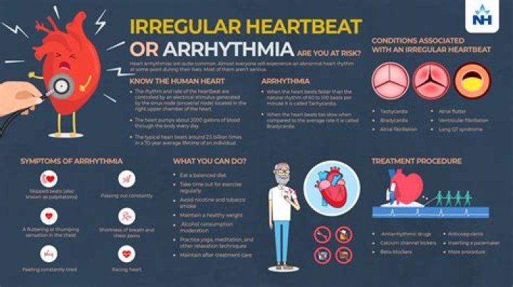 Can l arginine cause irregular heartbeat?