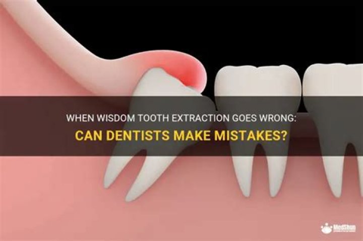 Do dentists make mistakes?