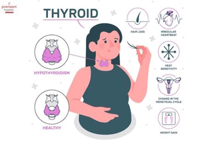 How do I know if my baby has hypothyroidism?