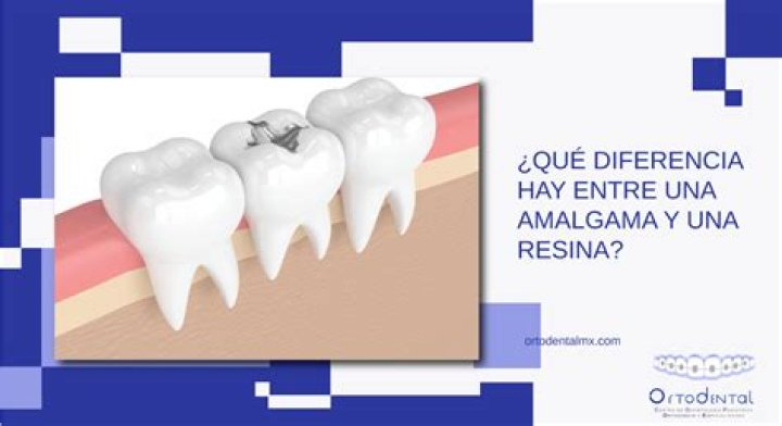 ¿Qué es mejor una amalgama o resina?