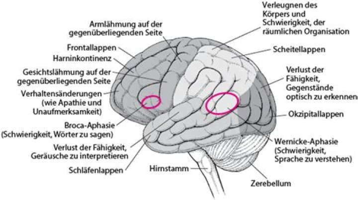 Was ist ein klinischer Soziopath?