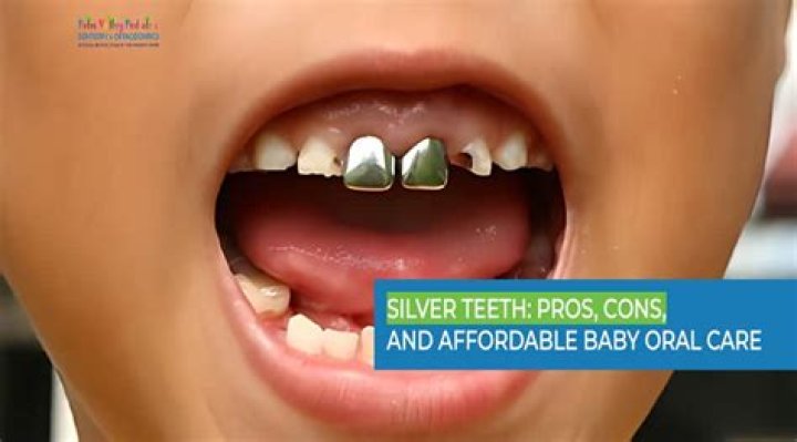 What happens if your silver tooth comes out?