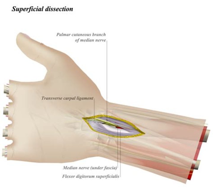 What is a volar surface?