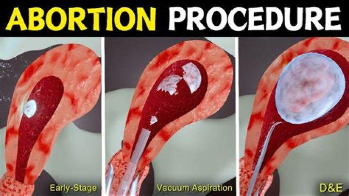 What is an abortive sale?