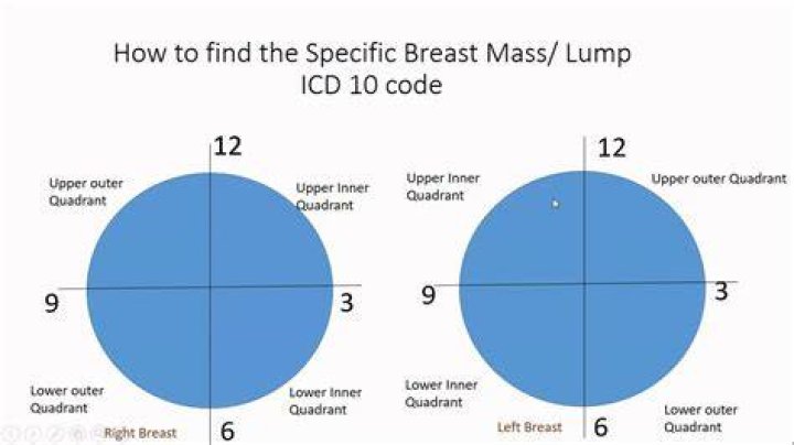What is the ICD 10 code for left breast nodule?