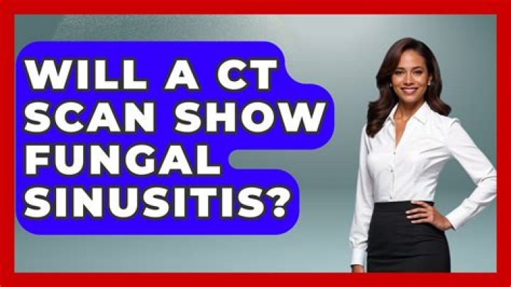 Will a CT scan show fungal sinusitis?